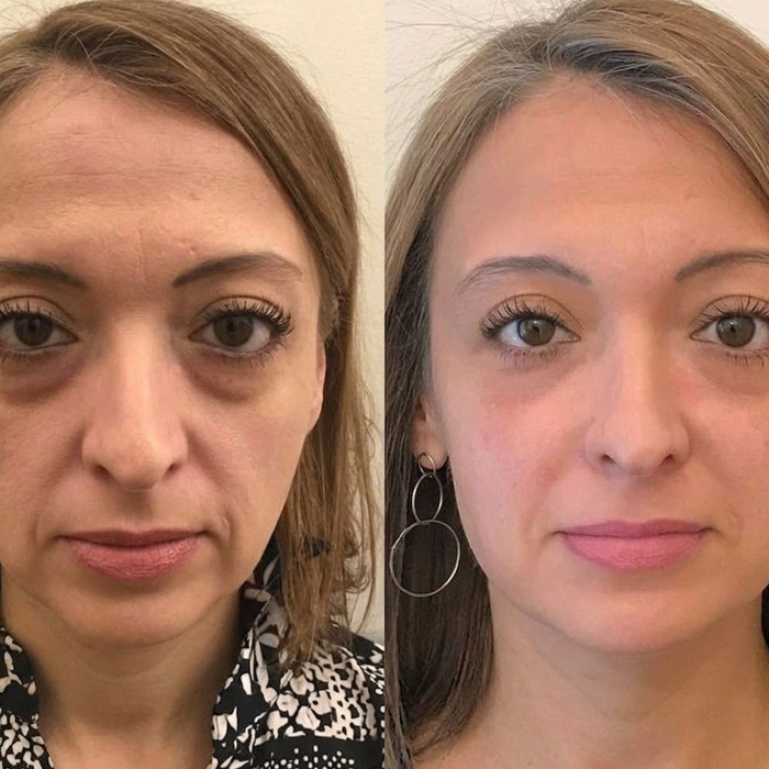 Sylovona Glow™ Retinol Eye Stick for daily under-eye care