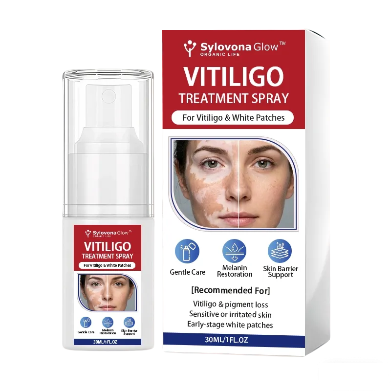 Sylovona Glow™ Vitiligo Treatment Spray