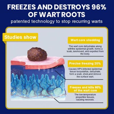 Cvreoz® cryo treatment spray