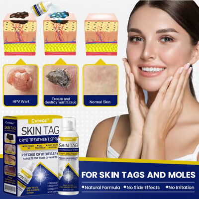 Cvreoz® single-item spray product