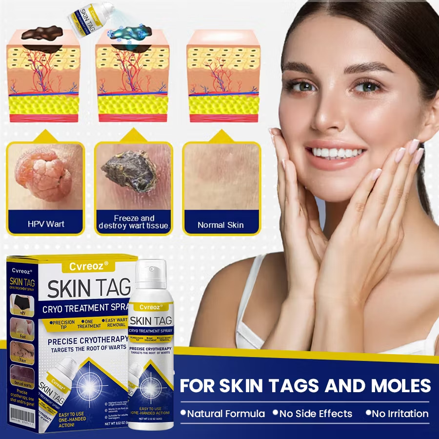Cvreoz® single-item spray product