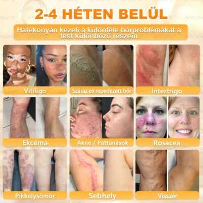 𝖠𝖯𝖪𝖠𝖯𝖪® krém aloe verával, shea vajjal és jojobaolajjal